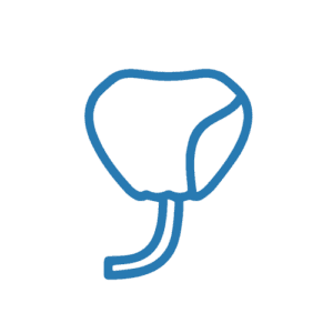 Prostate Cancer