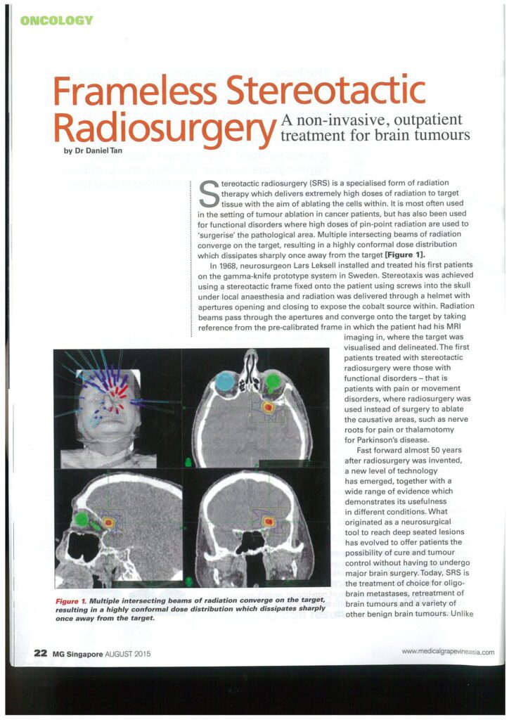 Medical Grapevine Frameless Stereotactic Radiosurgery