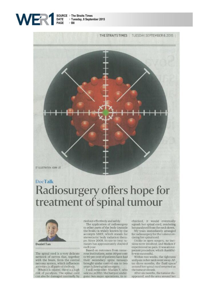 Radiosurgery offers hope for treatment of spinal tumour
